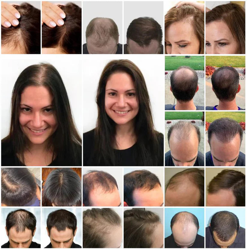 Ouhoe™ Capilar tónico crecimiento capilar acelerado