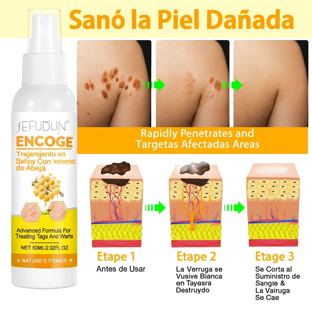 Tag Recede™ Spray Eliminador de Verrugas